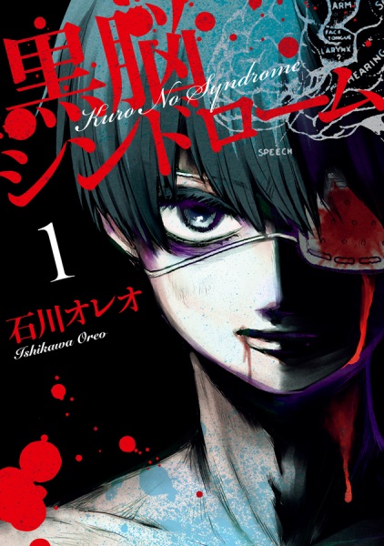 Синдром чёрного мозга